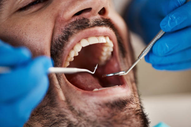 Best Full Mouth Reconstruction  in Combes, TX