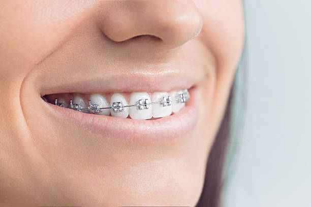 Best Full Mouth Reconstruction  in Combes, TX